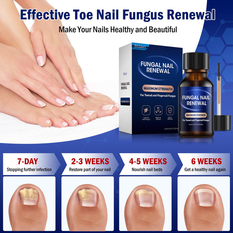 Toe Nail Fungus Renewal, 2-Pack Toenail Fungus Renewal, Fast Acting For Thick, Discolored, Broken & Damaged Toe & Finger Nail
