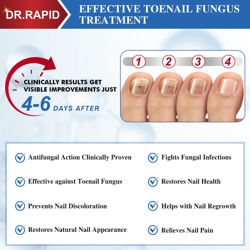 Toenail Fungus Treatment Extra Strength - Effective Antifungal Nail Repair Solution with Tea Tree Oil for Toenail & Nail Fungus, Fast Acting Treatment for Damaged Nails & Ingrown Toenail - 30ml/1fl oz 1 Fl Oz (Pack of 1) - BeesActive Australia