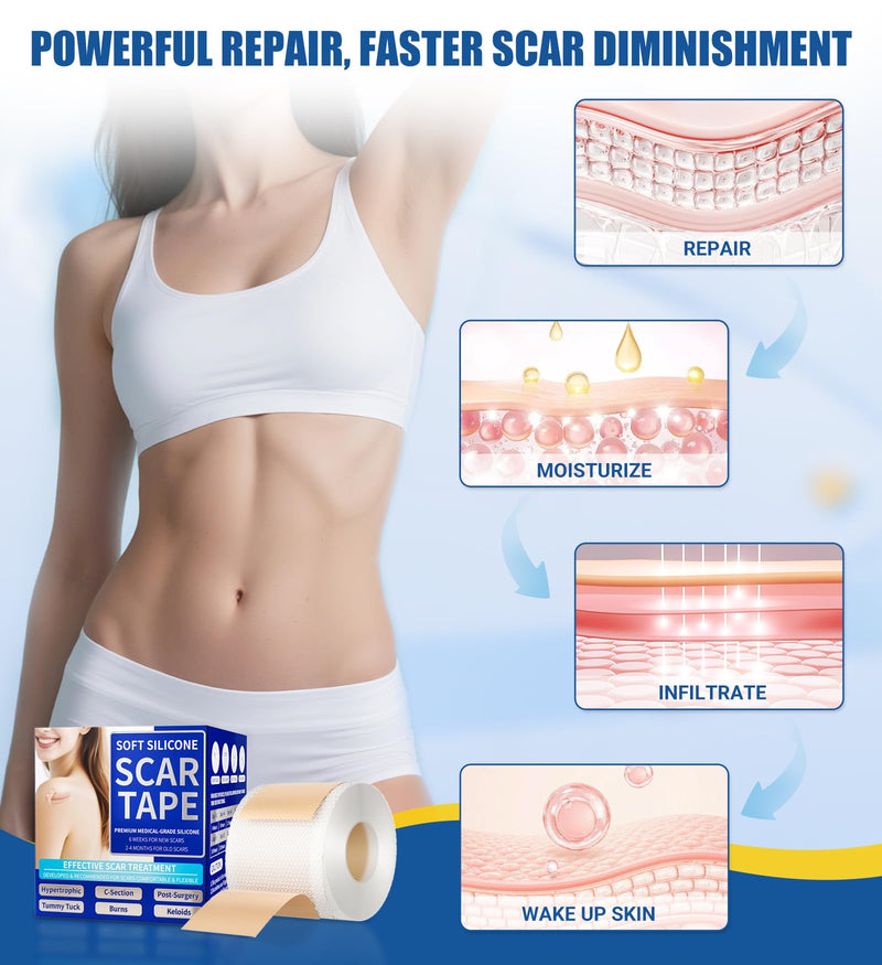 MasterMo Medical Grade Silicone Scar Sheets & Tape - Ultra Soft, Hypoallergenic Rolls (1.6‚Äùx60" Roll) for Surgical, C-Section, Tummy Tuck, Keloid Scars, Stretch Marks & Burn Scar Removal 1.5M - BeesActive Australia