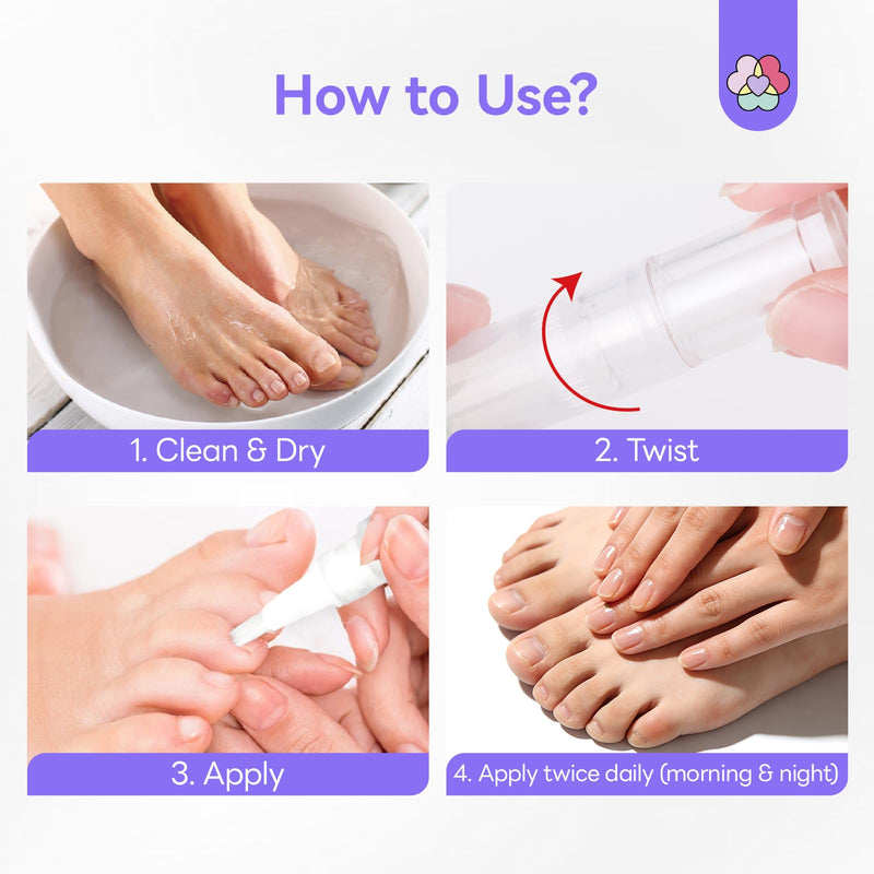 SAVILAND Toenail Fungus Pen Extra Strength: 2X Extreme Nail Repair 25% Undecylenic Acid 1% Tolnaftate Nail Fungus Pen for Damaged Yellow Discolored Thick Foot Toe Nails Softener Treatment Solution - BeesActive Australia