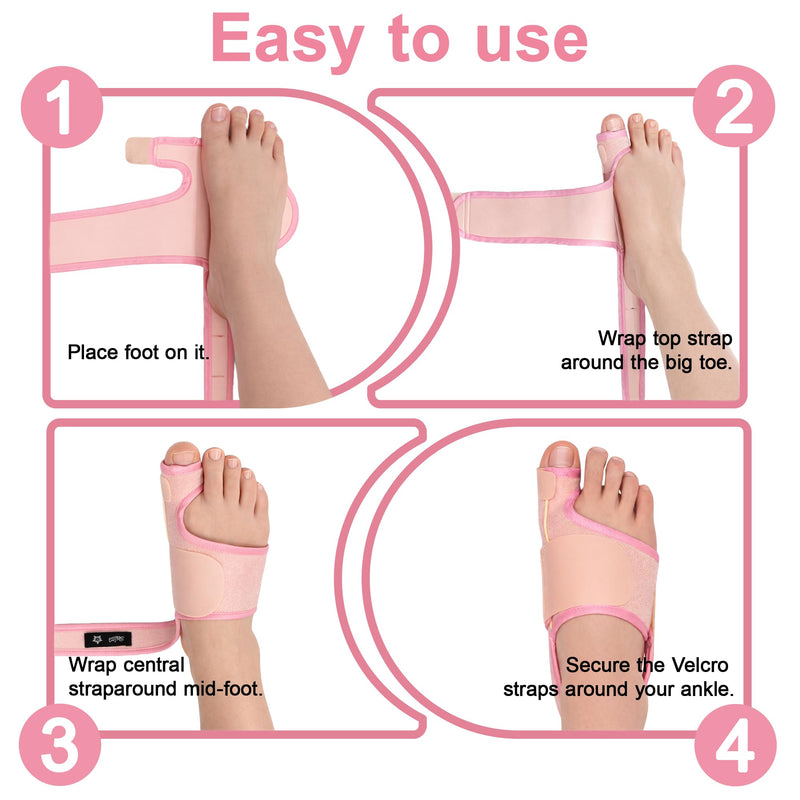 SPRING SEAON 2-Pack Bunion Corrector for Women & Men, Interchangeable 2-Level Stiffness Plates, Adjustable Big Toe Splint Toe Brace for Hallux Valgus, Day/Night Support, Toe Straightener (Pink) Pink