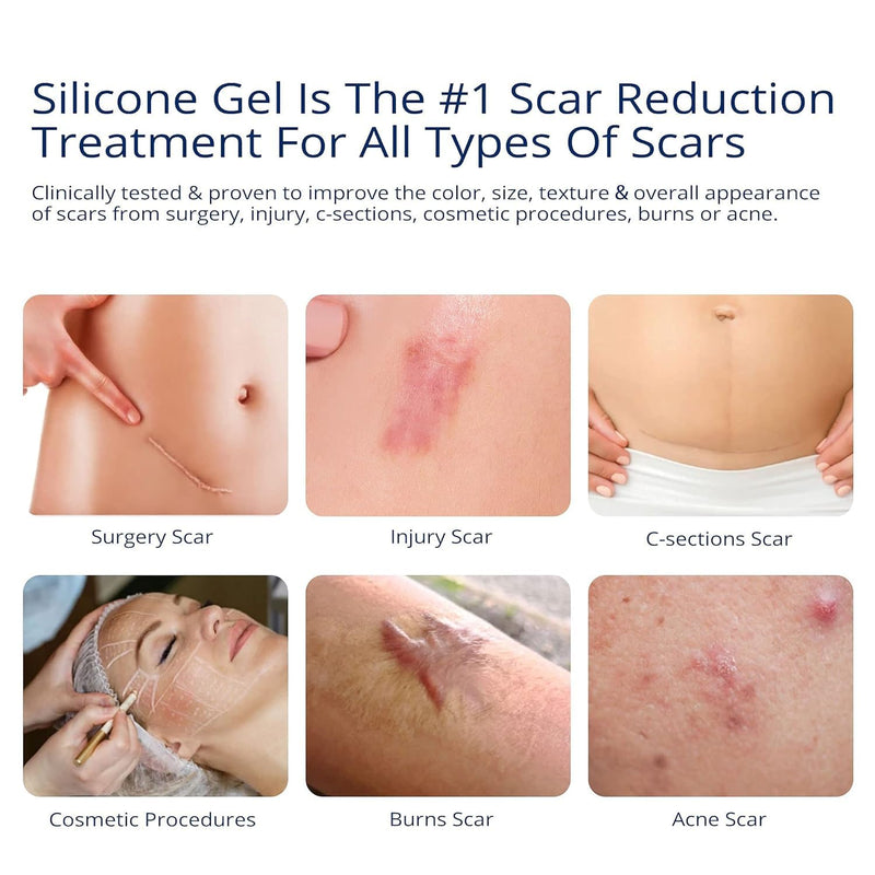 100% Silicone Scar Gel Scar Cream - Advanced Scar Gel for Surgical Scars, C-Section, Stretch Marks, Acne, Injury, Burns, Keloids, Old and New Scars 1.06oz(30g) (Maximum Strength 100% Silicone) Maximum Strength 100% Silicone