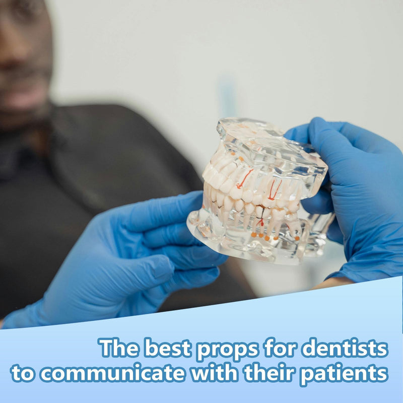 Transparent Disease Teeth Model with Dental Implant Bridge, Dental Teach Crown Bridge Removable Model, Tooth Model for Patient and Dental Student Education. (Red) Red - BeesActive Australia
