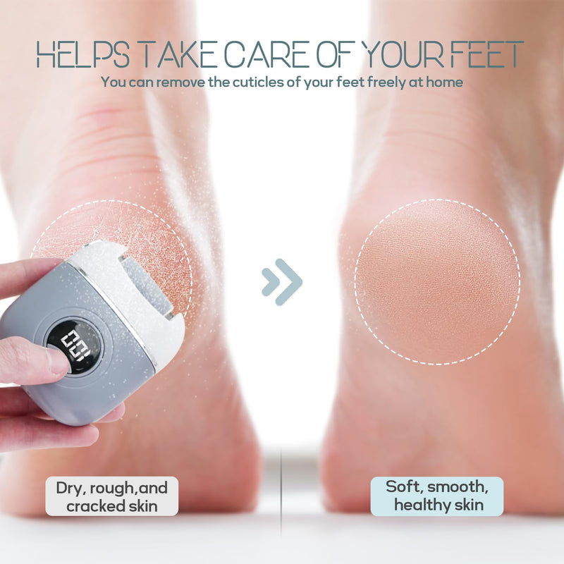 Electric Foot Callus Remover, Rechargeable & Waterproof Pedicure Tool with 3 Roller Heads, 2 Speeds for Dead, Hard, Cracked, Dry Skin Care - BeesActive Australia