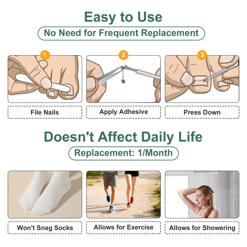 Dual Nitinol Ingrown Toenail Corrector,Ingrown Toenail Treatment,Curved Toenail Straightener,Ingrown Toenail Removal Kit,Big Toe Ingrown Toenail Tool (0.55in,0.66in) 0.55in,0.66in - BeesActive Australia