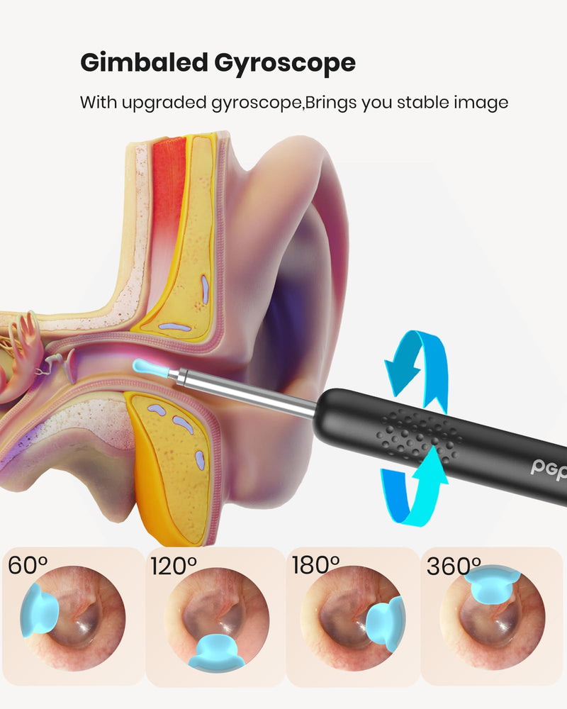 BEBIRD R1 Wax Removal Tool for Ear - Spade Ear Canal Cleaner with Camera 1080P Earscope, Wax Remove Ear Picker with Vari Replacement Tips, Camera with 6LED Light for Ear/Nose/Throat Examination, Black - BeesActive Australia