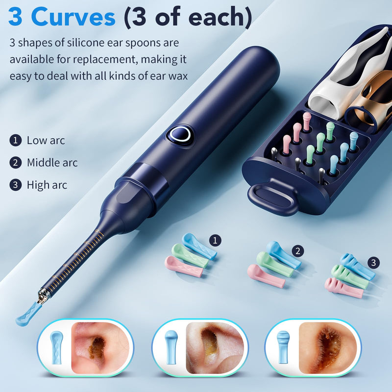 Ear Wax Removal, Ear Cleaner with Camera 1296P HD,Visual Ear Cleaner with 6 LED Lights and Flexible Tip,FSA HSA Eligible Items,Safe Ear Wax Removal Kit with Camera,Ear Cleaning Tool for Family Gifts Black - BeesActive Australia