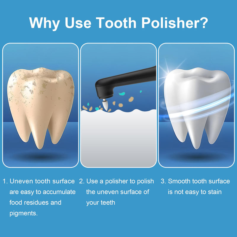 Tooth Polisher - SIQUER Plaque Remover for Teeth Whitening Dental Tools Electric Tartar Polishing Teeth Cleaning Kit with LED Light 5 Speed Modes with 5 Replacement Brush Heads (Black) Black