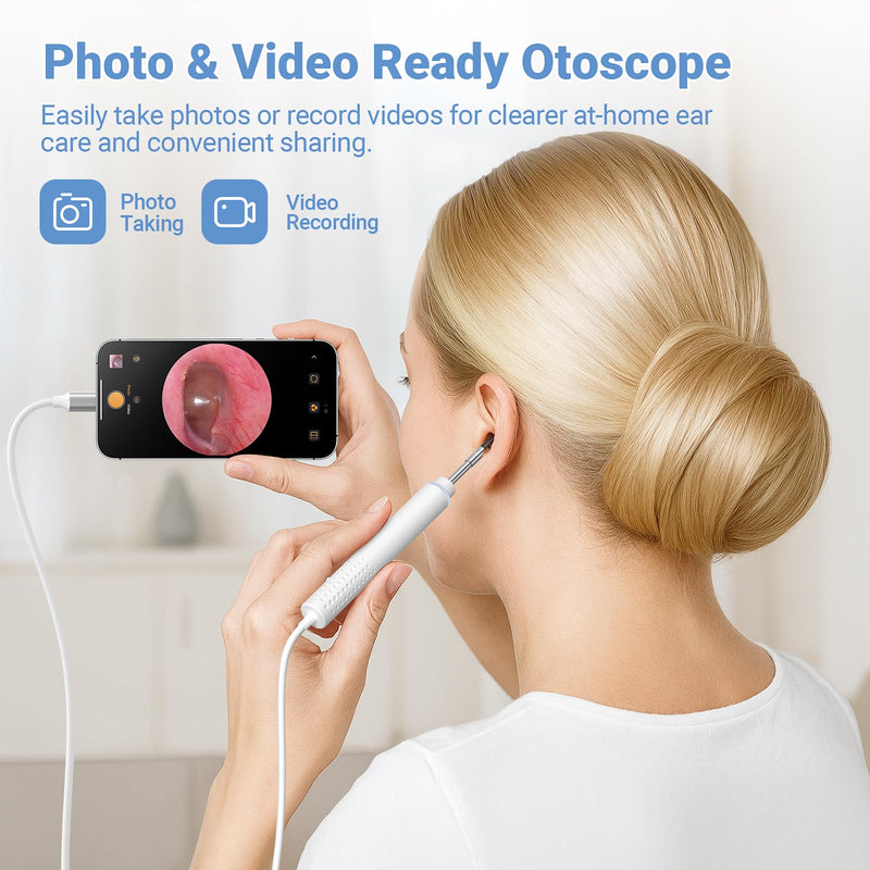 ScopeAround Otoscope with Light, 720P HD Ear Cleaning Camera & 6 LED Lights Ear Scope, Digital Otoscope with Camera, Smart Endoscope, Plug & Play, USB-C Port - BeesActive Australia