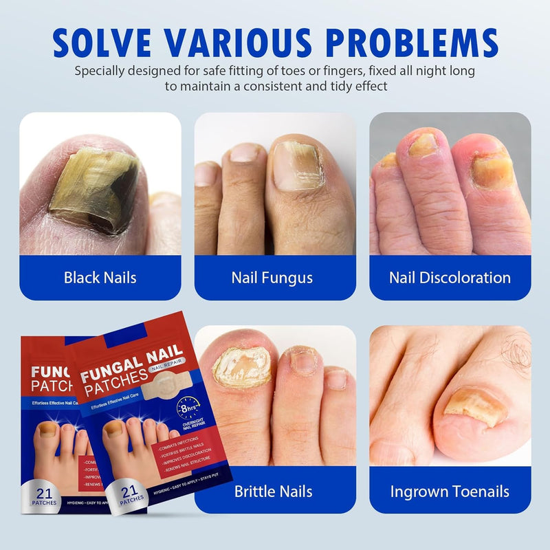 Nail Patches 21 PCS Toenail Treatment Extra Strength 8-Hour Overnight Nail Fast Acting Repair Effortless Hydrogel Nail Care and Repair for Damaged Nails Overnight Renewal for Men and Women 0 Ounce (Pack of 21)