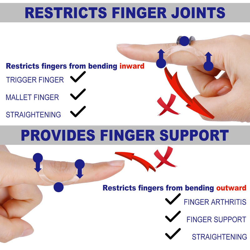 10Pcs Clear Oval Finger Splints & Sleeves Kit, 6 Graduated Trigger Finger Splint & 4 Finger Sleeves for Trigger/Mallet/Arthritis/Straightening, Finger Brace Support for Thumb/Middle/Ring/Index/Pinky(Size 4,5,6,7,8,9) Size 4,5,6,7,8,9