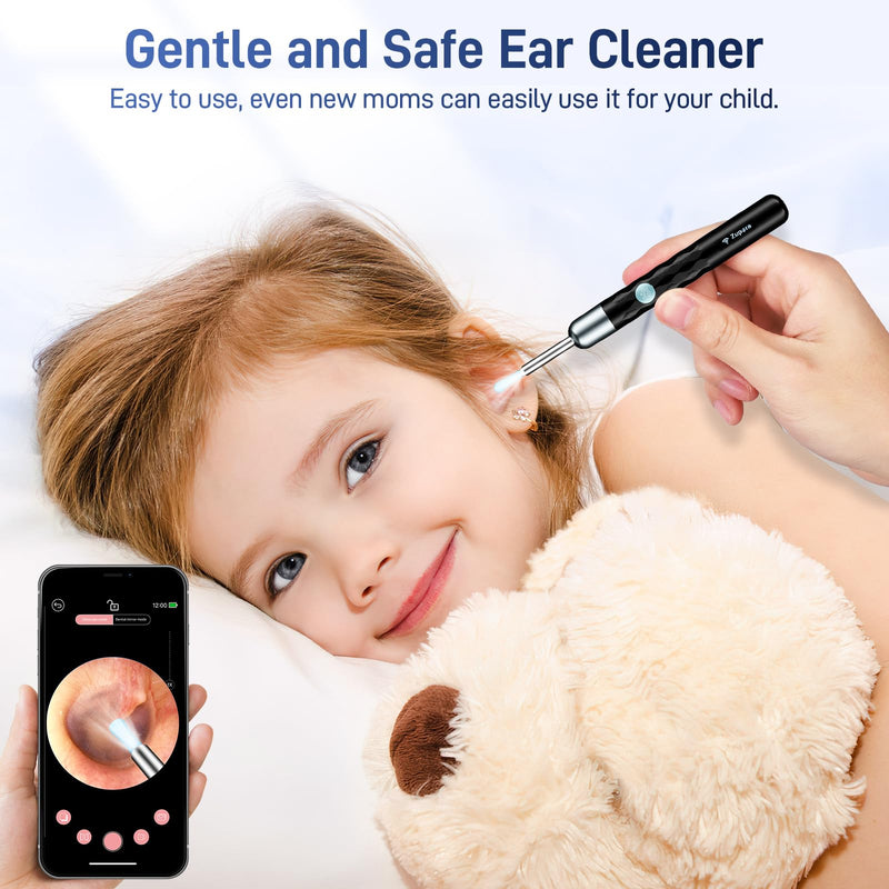 ZUPORA Ear Wax Removal, Ear Camera with 1440P HD, Ear Cleaner with Camera Built-in WiFi, Earwax Removal Kit with 6 Ear Pick, Otoscope with Lights, Ear Cleaning Kit for Android and iOS (Black) Black - BeesActive Australia