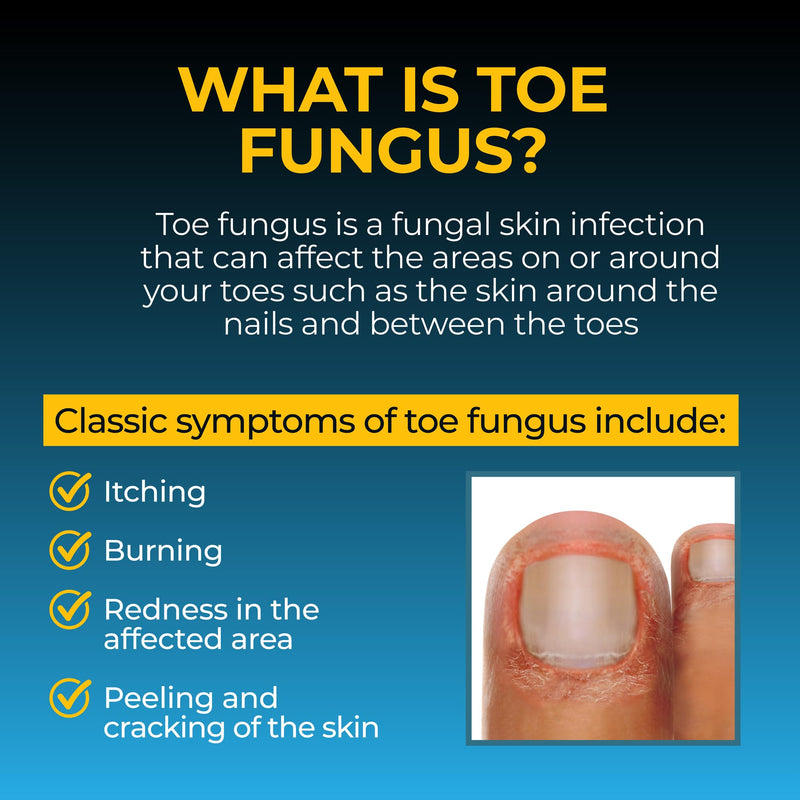 Fungi-Nail Anti-Fungal Foot Spray, Kills Fungus That Can Lead to Nail & Athlete’s Foot with Tolnaftate & Clinically Proven to Cure Infections - 1 Oz 1 Fl Oz (Pack of 1)