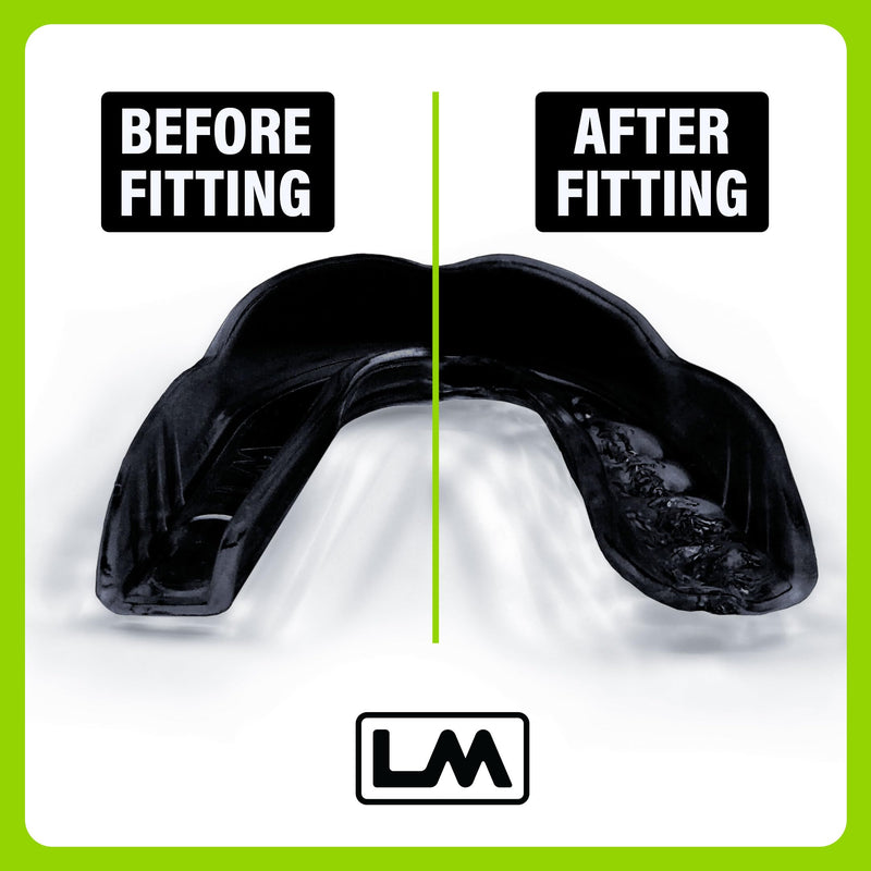 Loudmouth Sport Slim-Fit Boil & Bite Mouth Guard (2 Pack) Plus Mouthguard Case, Advanced Protection for All Contact Sports (Black) - BeesActive Australia
