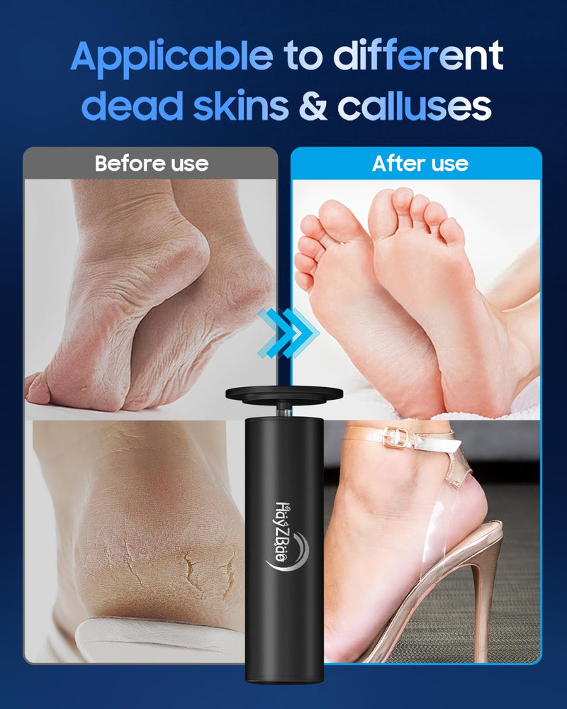 Electric Foot Callus Remover - Electric Callus Remover for Feet,Foot Scrubber with 60 Pcs Sandpaper Discs,Professional Pedicure Tool for Dead Skin - Black - BeesActive Australia
