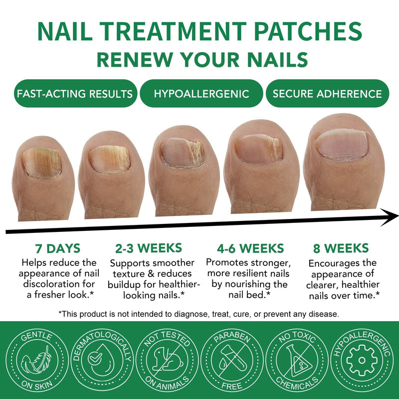 Toenail Treatment Extra Strength - 32 Pcs Nighttime Nail Patches for Toenails - Toe Nail Treatments for Nails Repair & Care - Easy to Use - BeesActive Australia