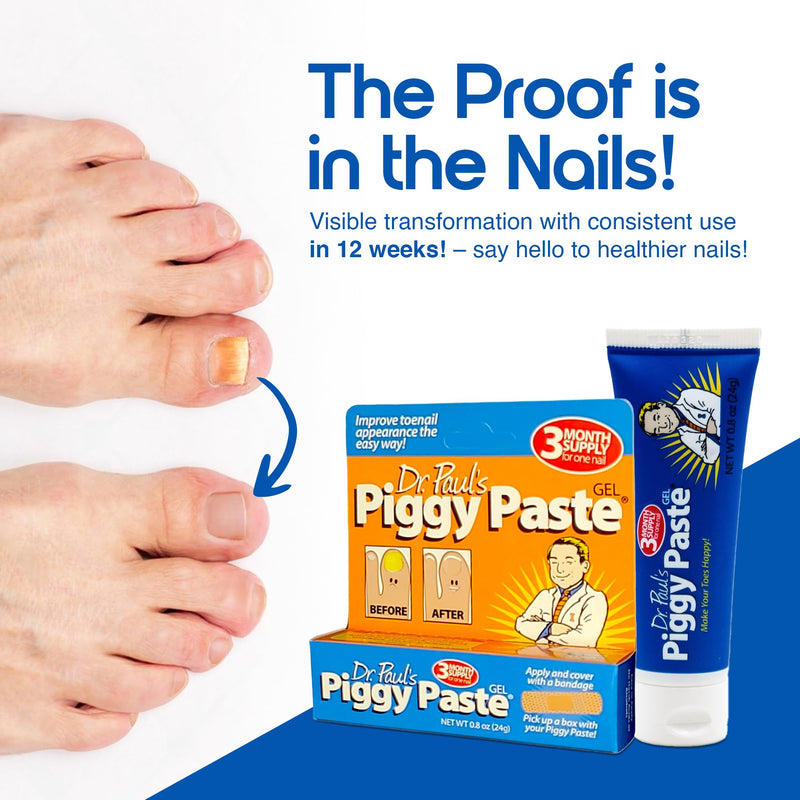 Dr. Paul's Piggy Paste Gel: Fast Acting Solution for Thick, Brittle, Yellow Nails, Restores Clear, Healthy Toenails & Fingernails, Easy, Mess Free Application Doctor Recommended Formula 0.8 Ounce (Pack of 1)