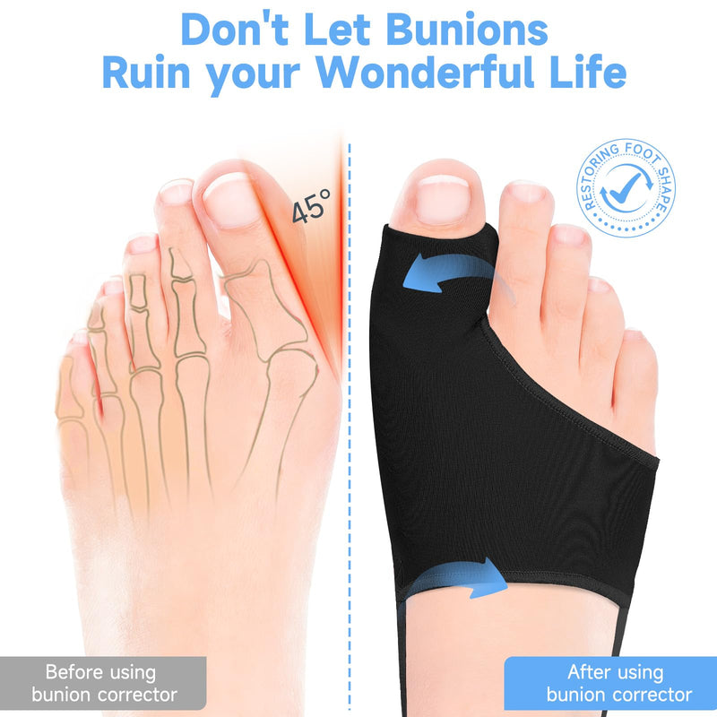 2PCS Bunion Corrector for Women & Men Big Toe, Big Toe Separators, Hammer Toe Straightener,Bunion Pads with Spacers, Hallux Valgus Pain Relief, Comfortable & Breathable for Day/Night Black 1 - BeesActive Australia