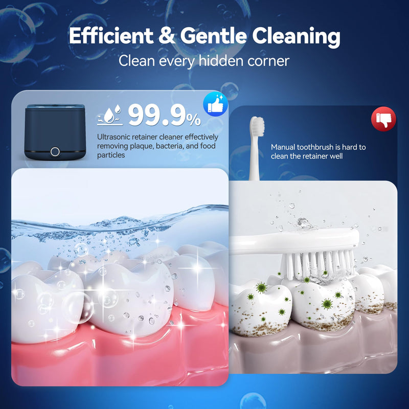 Miorcols Retainer Cleaner, 48kHz Ultrasonic Retainer Cleaner Machine for Denture, Mouthguard, Braces, Night Guard, Aligner, Toothbrush, Jewelry with 7.8OZ Dental Cleaning Pod-Blue