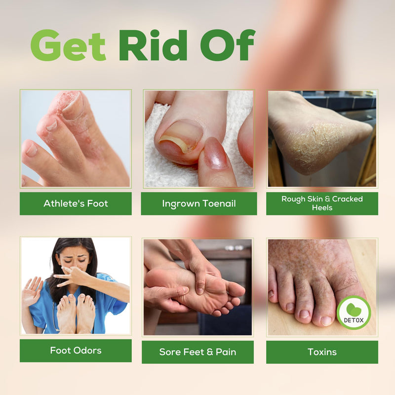 FOOT CURE Tea Tree Oil Foot Soak with Epsom Salt - Best Toenail Fungus Treatment, Athletes Foot & Softens Calluses - Soothes Sore & Tired Feet, Fungal Toe, Foot Odor Scent, Spa Pedicure (Pack of 2) | Tea Tree Oil, with Epsom Salt, Fungal Toe, Foot Odor... - BeesActive Australia