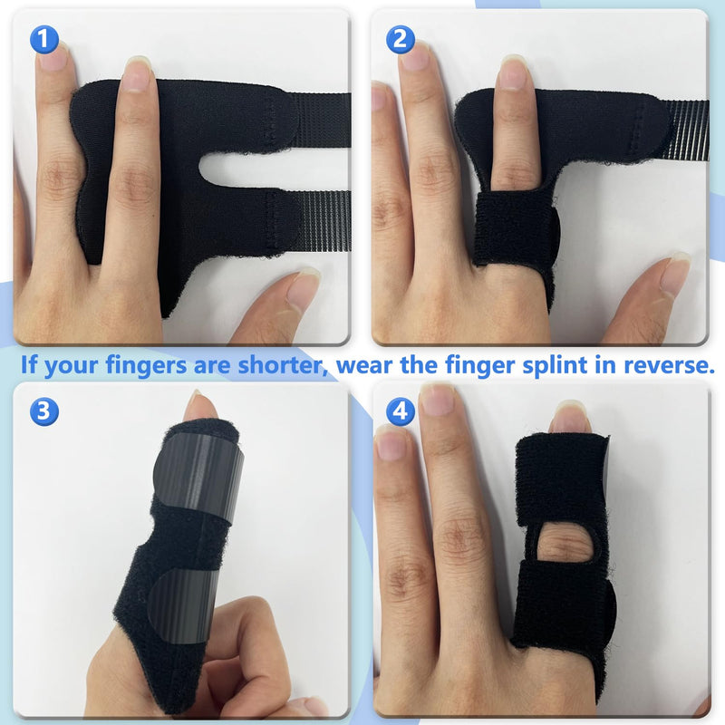2 Pack Adjustable Trigger Finger Splints, Support for Arthritis, Tendonitis, and Hand Injuries – Ideal for Index, Middle, and Ring Fingers, Comfortable Night & Day Use - BeesActive Australia