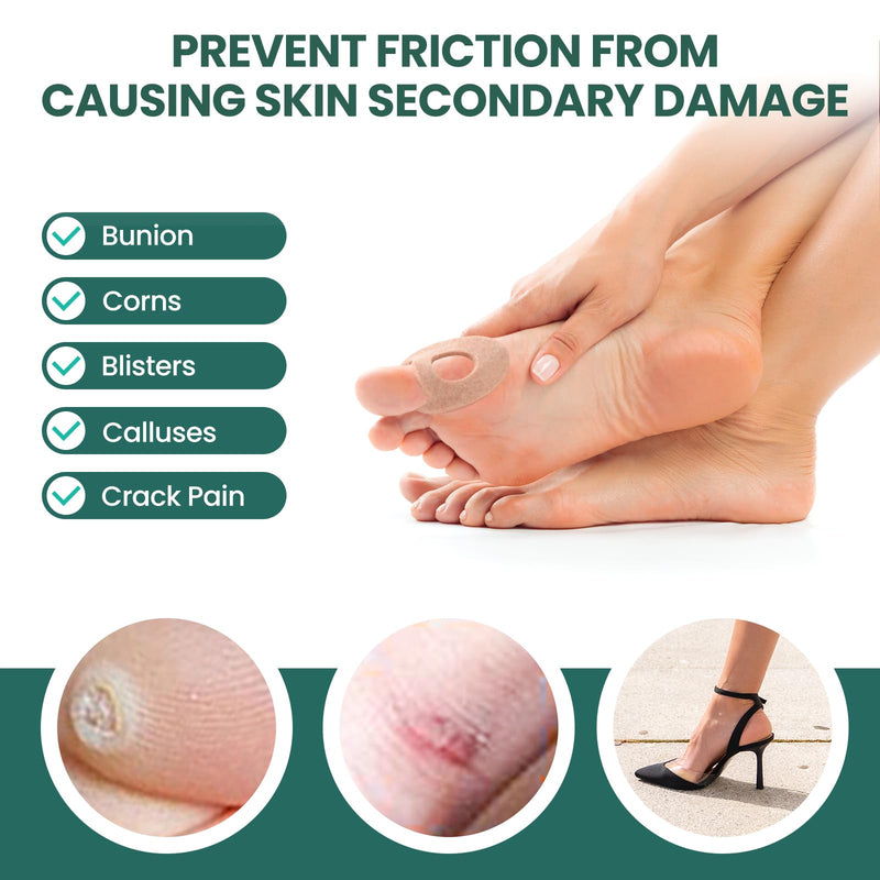 Welnove Bunion Pain Relief Pads, Removable Bunion Pads for Men and Women, Corn Pads for Toes, Metatarsal Cushion, Alleviates Shoe Friction to Wear with Shoes - 12 Count Beige