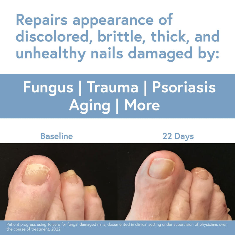 Tolvere Nail Renewal Solution, Rapidly Improve Appearance of Discolored, Brittle, and Cracked Nails - BeesActive Australia