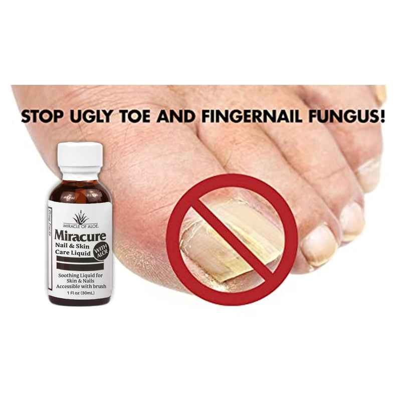 Miracle of Aloe’s Nail & Foot Care Liquid with UltraAloe, Brush & Toe Separators (1 oz)