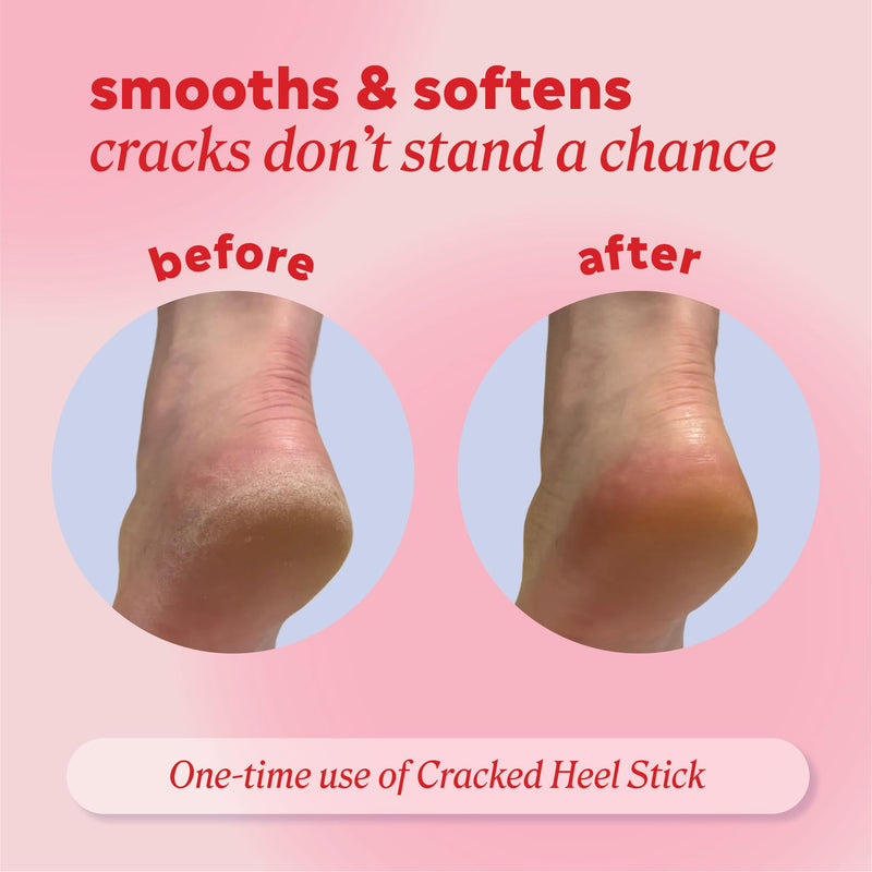 Onyx Professional Cracked Heel Repair Balm Stick for Dry Cracked Feet Treatment, Coconut Scent, 1 pack - Moisturizing Foot Balm, Rolls On, Cracked Heel Treatment 2.46 Ounce (Pack of 1) - BeesActive Australia