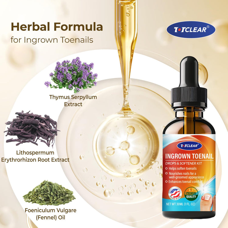Ingrown Toenail Relief: Ingrown Toenail Tool for Men Women - Ingrown Toenail Removal Kit - Ingrown Toenail Corrector Drops - Ingrown Toenail Removal - Effective Solution for Ingrown Toenails - 30ml 1 Fl Oz (Pack of 1)