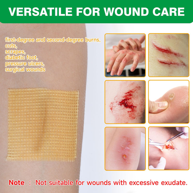 Manuka Honey Gauze Dressing, 4×4 Inches, 12 Individual Pack, Non Stick Gauze Pads, Manuka Honey Wound Care for Wound Healing from Burns, Abrasions, Cuts and Scald, FSA or HSA 4×4 Inch