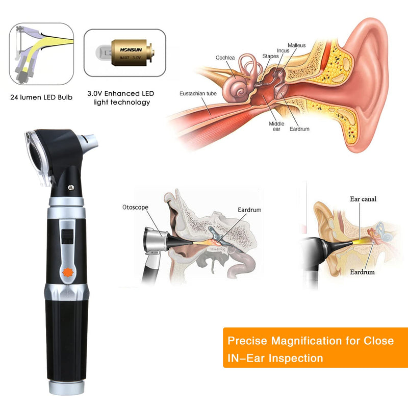 Otoscope Kit,Professional Diagnostic Ear Care Tool with 3.0V LED Bulb, 3X Magnification, 4 Speculum Tips Size - for Children, Adults, Pets, etc. - BeesActive Australia