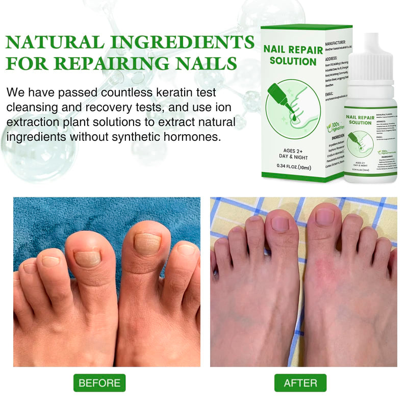 Nail Drops for Treating Toenail Odor and Fungal Infections, and Nail drops - BeesActive Australia