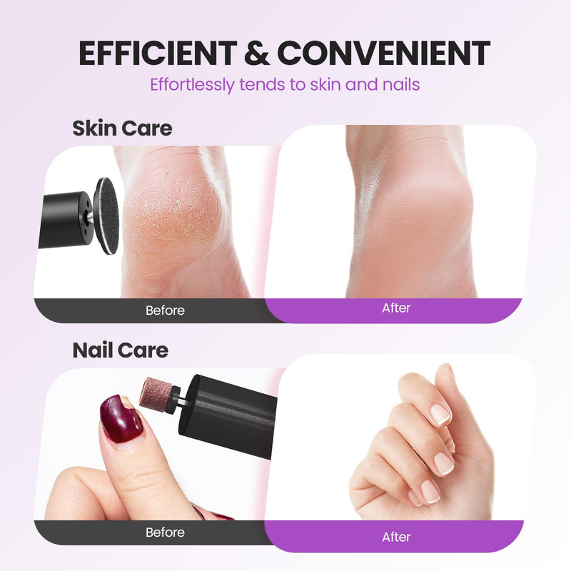 Electric Foot Callus Remover, 2 in 1 | 6 Speed Adjustable Foot File Nail Grinder with Sandpaper Disks, Professional Sander Pedicure Tool for Feet Dead Skin, Self Care Gifts for Women Mom Lover Friends 01-Electric Callus Remover Black - BeesActive Australia