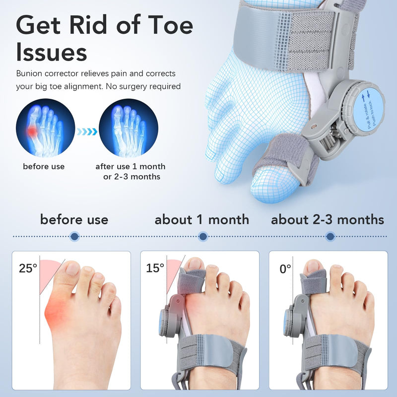 Bunion Corrector for Women Men: Big Toe Straightener Bunion Fix with Adjustable Knob-Orthopedic Bunions Splint Brace Toe Alignment Correction for Hallux Valgus Pain Relief Day/Night 1PCS (Grey) Grey - BeesActive Australia