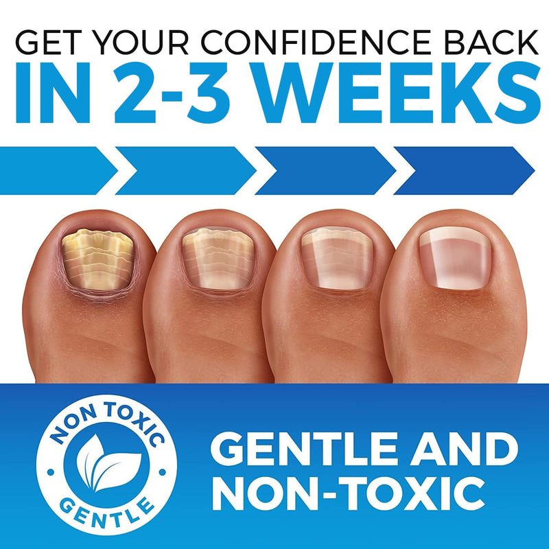Toenail Fungus Treatment Extra Strength (FDA REGISTERED) - Fungi Nail Fungus Cream - XL - Nail Strengthener and Growth Improved Formula (Made in USA) Toe & Nail Fungus