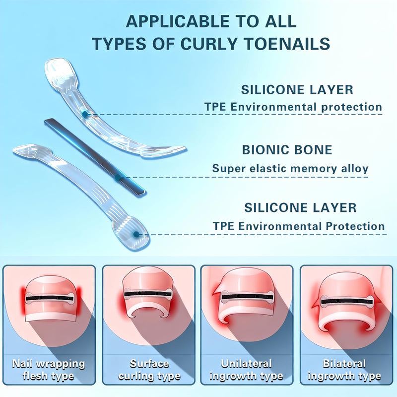 Titanium Alloy Ingrown Toenail Treatment - Professional Home Care for Curved Nails - Waterproof, Nail Tools and Ingrown Toenail Removal Kit,Ingrown Toenail Corrector(0.59/0.67in) Blue