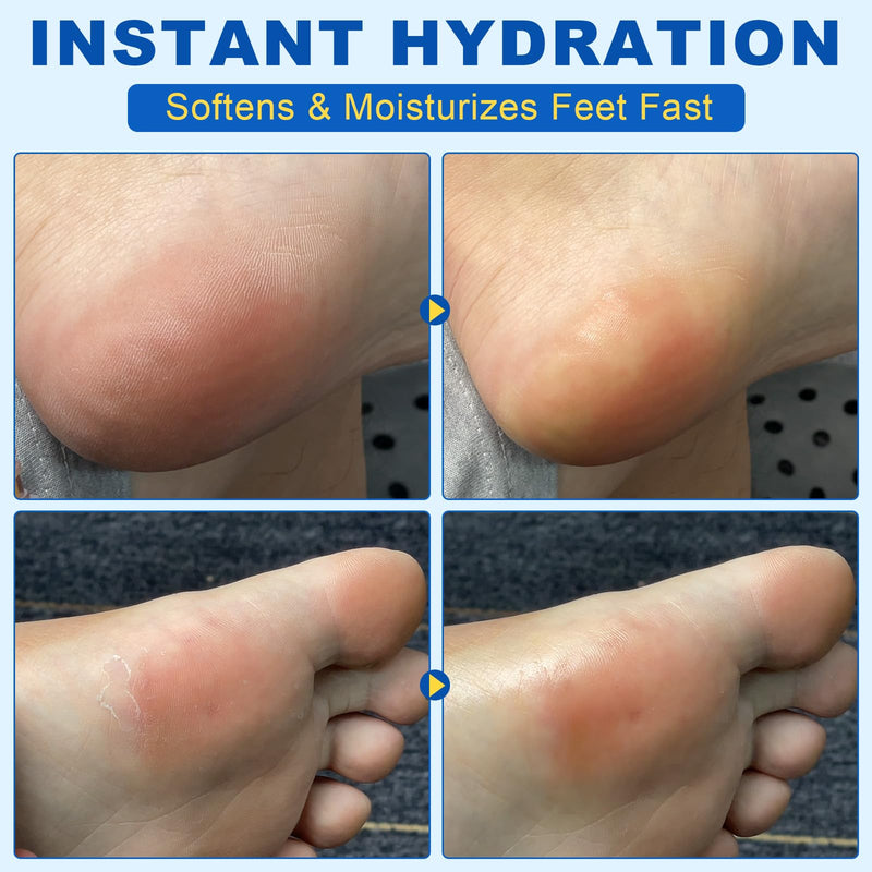 Bieyoc 60% Urea Cream with 2% Salicylic Acid, Urea Foot Cream Stick for Cracked Heels, Calluses and Rough Skin, Portable Foot Balm Stick No-Mess Applicator,1.41oz 1.41 Fl Oz (Pack of 1) - BeesActive Australia