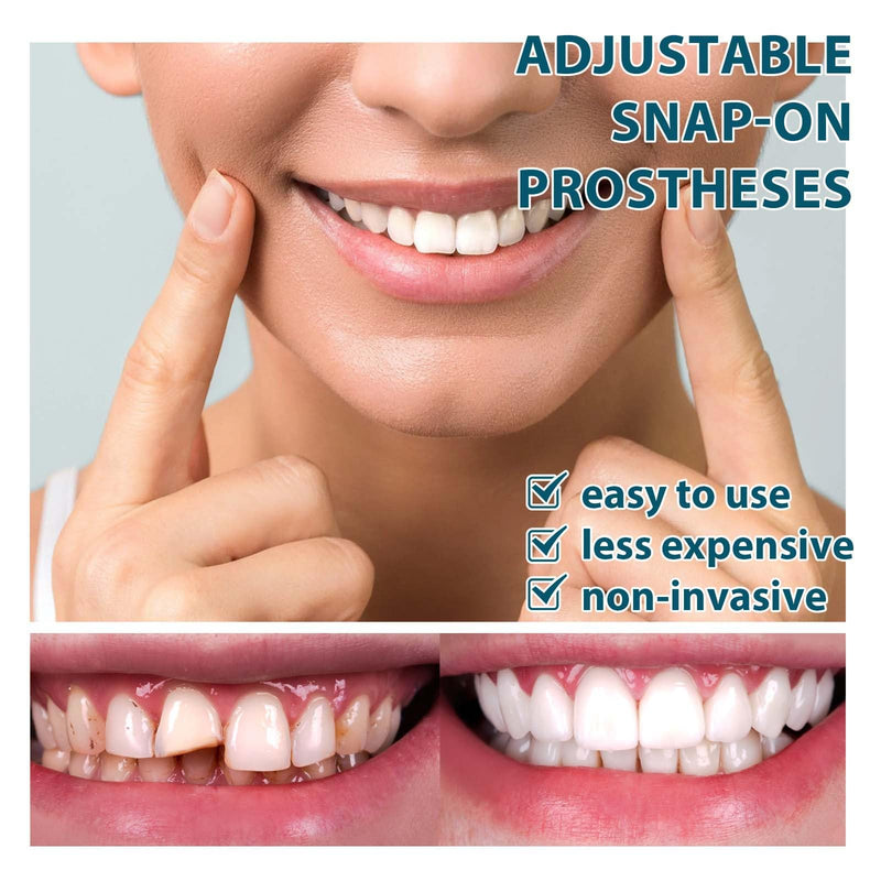8 Set Fake Teeth Natural White Artificial Teeth, Comfort-fit and Life-Like Teeth for Male and Female, Rediscover Your Confident Grin with Elegance,veneers Teeth for Women (8) 8 - BeesActive Australia
