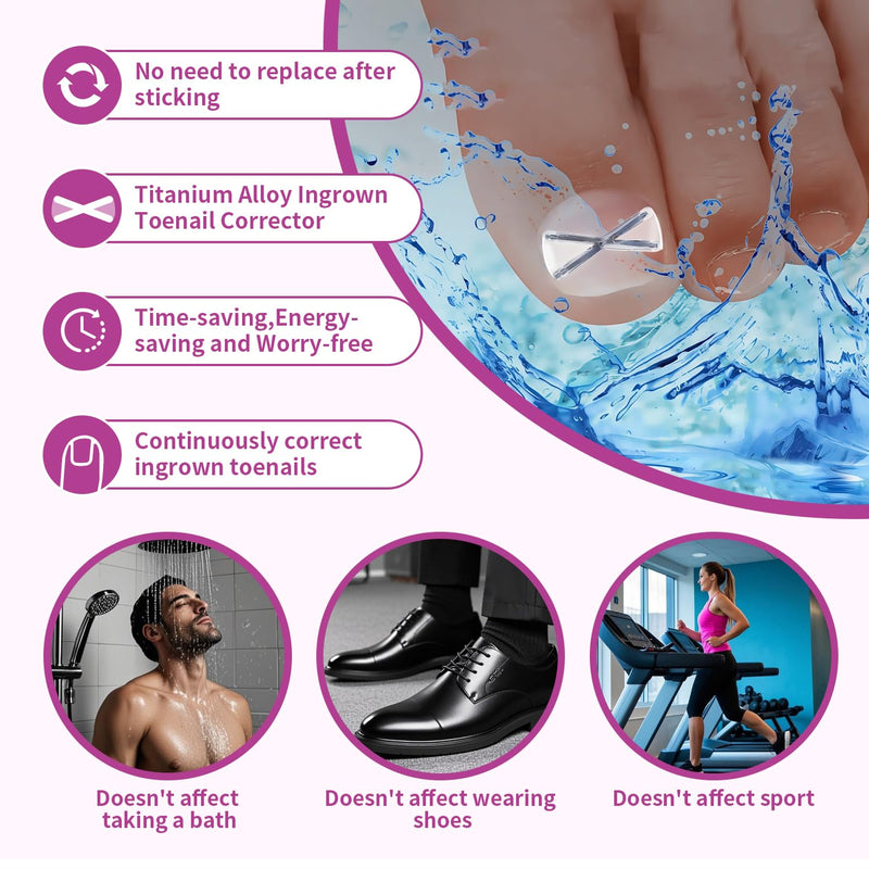 10 Patchs X-Shaped Upgrade Titanium Alloy Ingrown Toenail Corrector,At Home Ingrown Toenail Treatment for Man and Women,Ingrown Toenail Removal Kit,Curved Toenail Straightener (1 Count (Pack of 16)) 1 Count (Pack of 16)