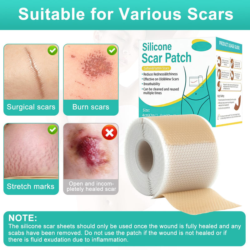 Silicone Scar Sheets(1.6” x 120” Roll-3M), Reusable Silicone Scar Tape for Surgical Scars, C-Section Scars, Stretch Marks, Hypertrophic Scars, Burn Scars, Tummy Tuck and Keloid Scars - BeesActive Australia