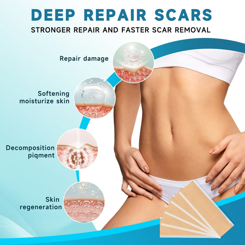 Rvlaim Medical Grade Silicone Scar Sheets (5.7" x 1.57"10 Pcs), Professional Silicone Scar Tape for Surgical C-Section, Keloid, Burn & Acne Scars - Reusable, Waterproof, Stickiness Upgrade 10 Pcs(5.7" x 1.57" ) - BeesActive Australia