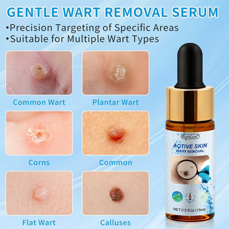 Natural Wart Oil Liquid Drops – Fast, Safe for Kids, Maximum Strength Wart Ointment with Pure Essential Oils – No Pain, No Scarring, Easy to Use on Face, Neck, Body, Hands, Feet
