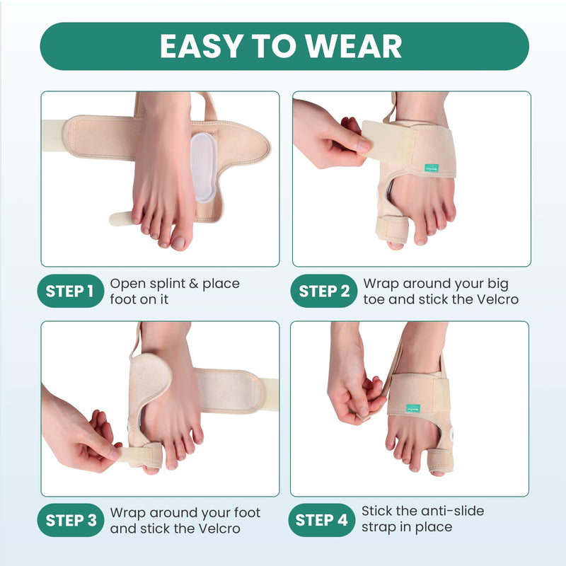 Welnove Bunion Corrector Women & Men Big Toe: 1 Pair Bunion Splint - Adjustable Bunion Correction - Toe Straightener with Non-slip Strap, Day Night Support (Beige) - With 2 Gel Separators