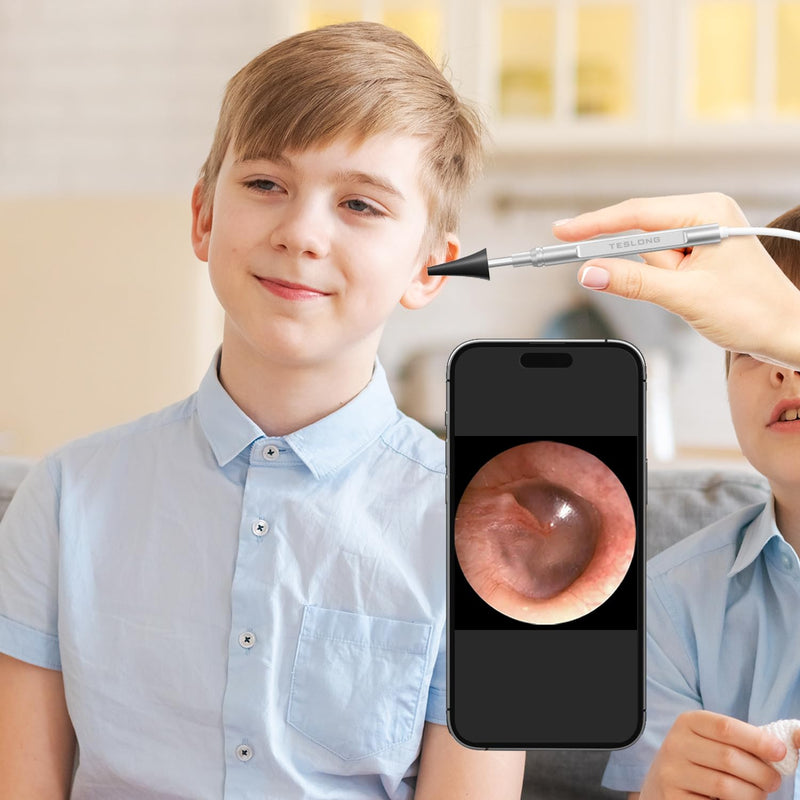 Teslong Digital Otoscope with Light, 1080p HD Ear Camera with Ear Wax Removal Tools, Video Ear Scope Otoscope with Light, Compatible with iPhone15, iPad, Android Phone, USB, Ear Picks, Waterproof - BeesActive Australia