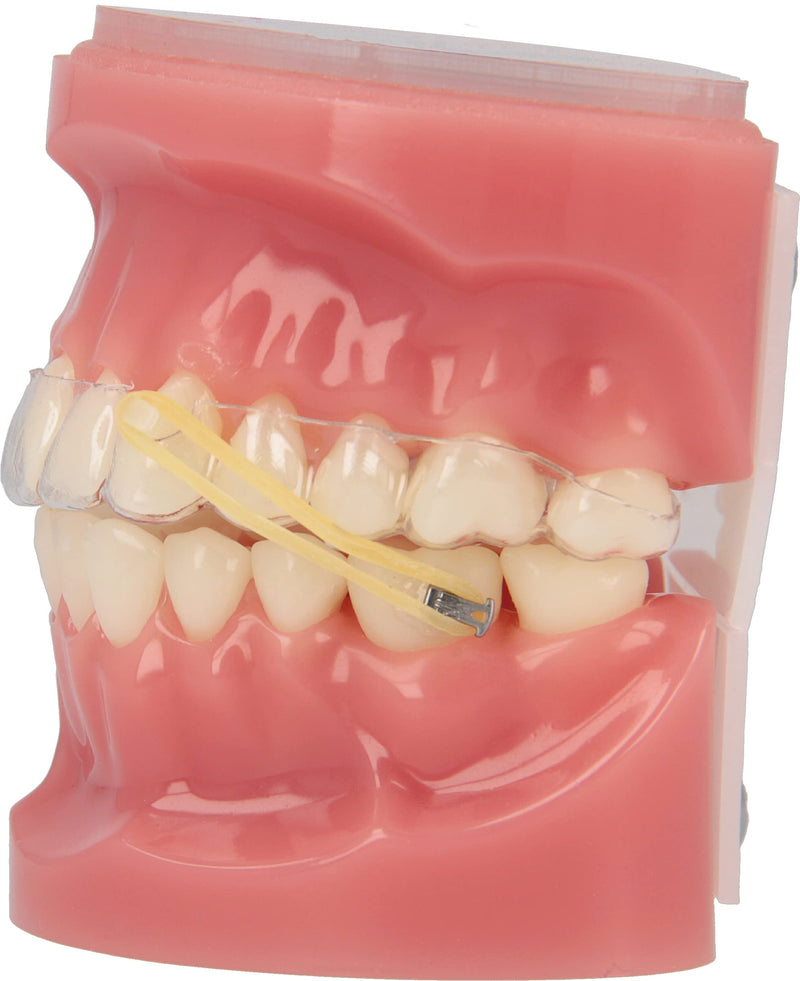 American Orthodontics Sea Lion Elastics, 1/4 in, 6.5 oz, Latex, Neon Heavy, 6.5 Oz 7500
