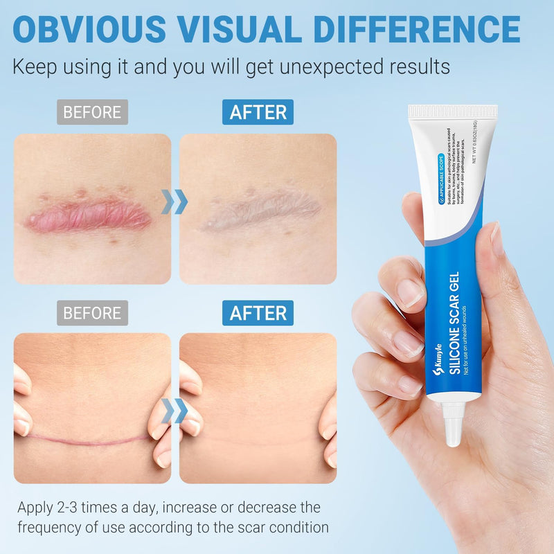 Silicone Scar Gel, Scar Cream, Advanced Scar Stick for Surgical Scars, Stretch Marks, Keloid Bump Removal, Old and New Scars 0.63oz (18g) 0.63 Ounce