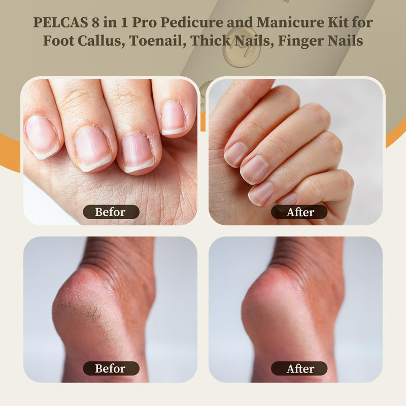 PELCAS 8 in 1 Cordless Nail Drill, Electric Nail Filer 5 Speeds Manicure & Pedicure Kit with LED Light, Electric Foot Callus Remover for Foot Callus, Toenail, Thick Nails, Finger Nails Golden - BeesActive Australia