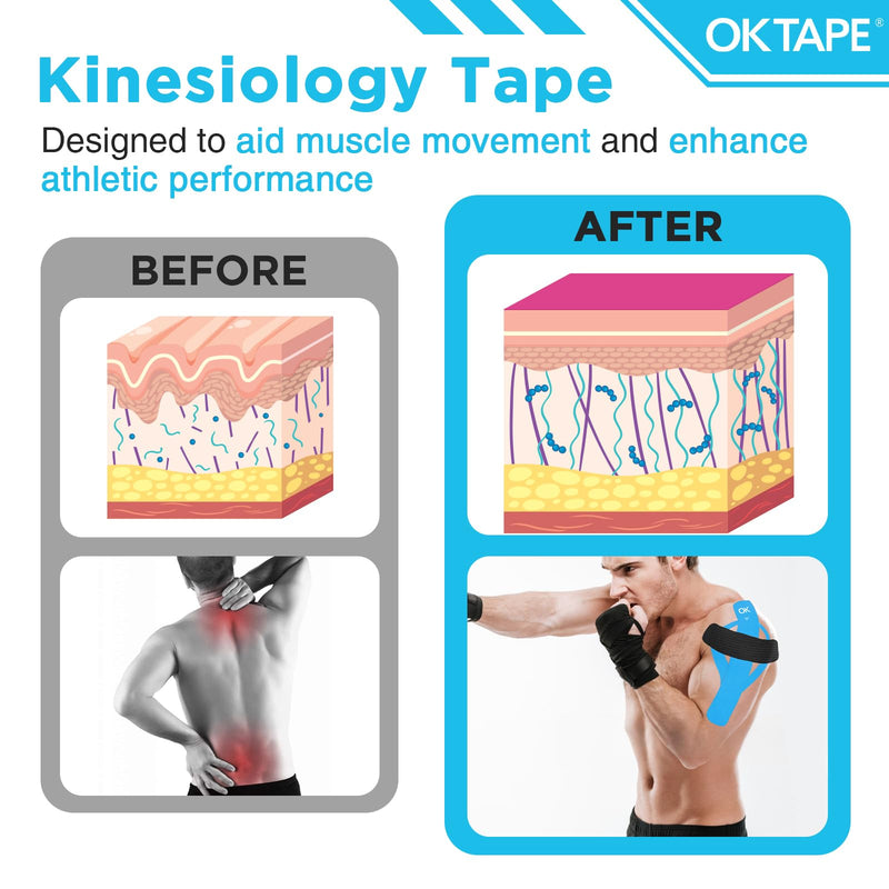 OK TAPE 100Pcs Precut Kinesiology Tape Strips, Elastic Athletic Tape for Joints Support & Muscle Pain Relief, Waterproof, Kinetic Tape for Shoulder, Knee, Ankle (5 Colors, 2 inch x 10 inch) Mixed 100 Pcs
