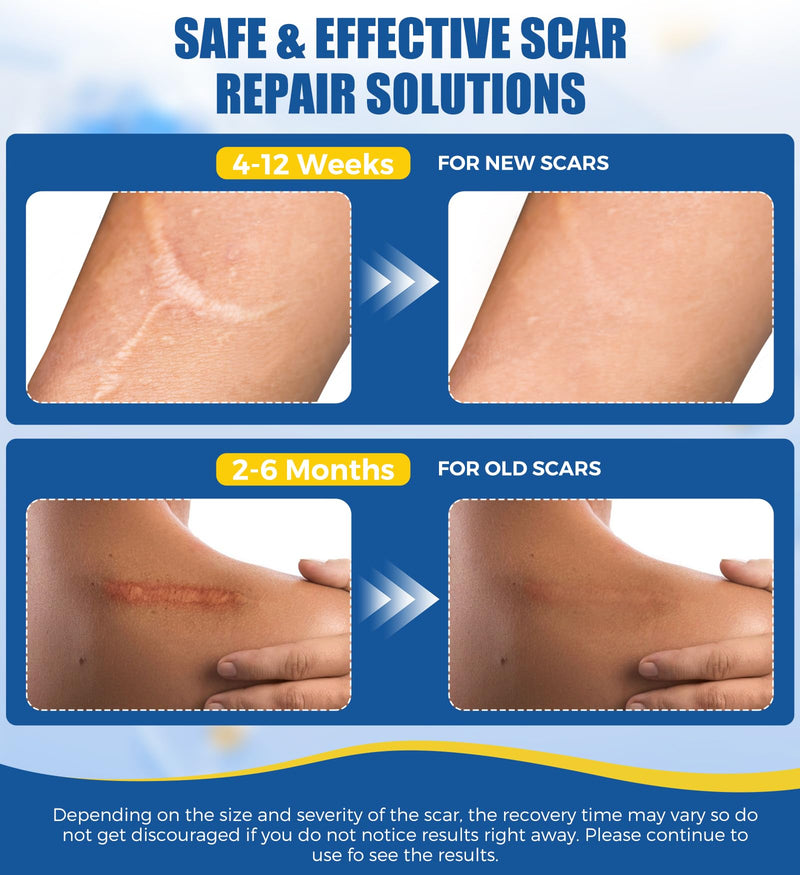MasterMo Medical Grade Silicone Scar Sheets & Tape - Ultra Soft, Hypoallergenic Rolls (1.6‚Äùx60" Roll) for Surgical, C-Section, Tummy Tuck, Keloid Scars, Stretch Marks & Burn Scar Removal 1.5M - BeesActive Australia